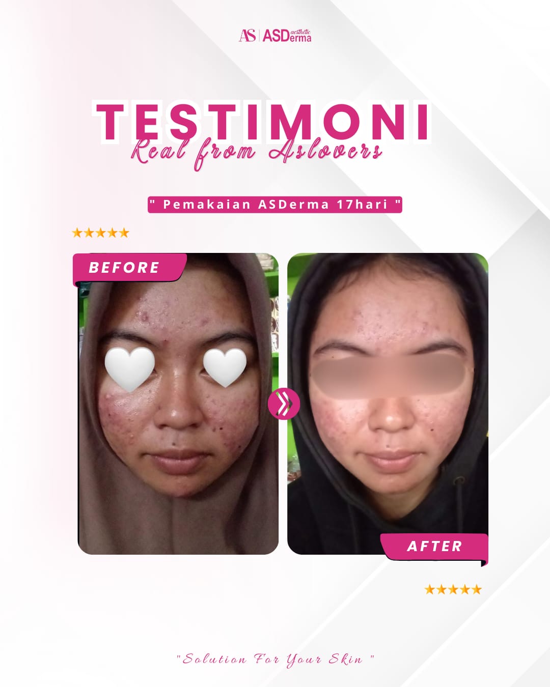 Testimoni 3